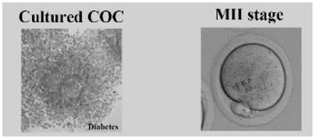 培养液及提高母源糖尿病卵子质量的方法与流程