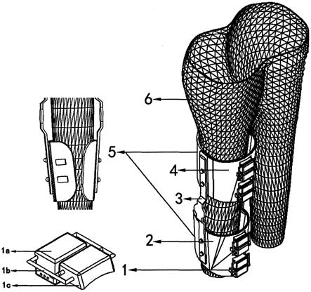 一种能随下肢肌肉变形而改变形态的膝关节矫形器的制作方法