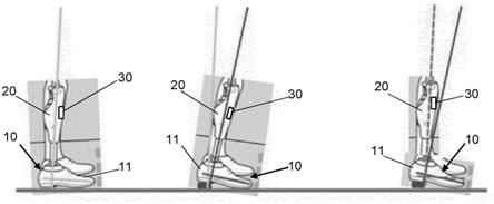 用于下肢的假体装置、用于假体装置的调设装置和用于手动调设的方法与流程