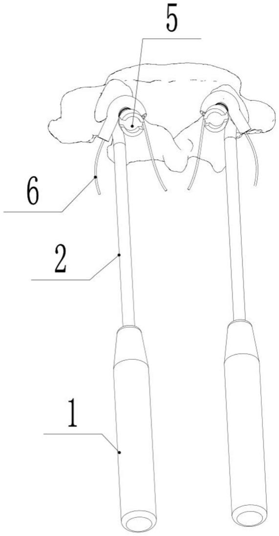 脊柱手术用空心导丝器的制作方法